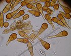 Puccinia phragmitis MykoGolfer