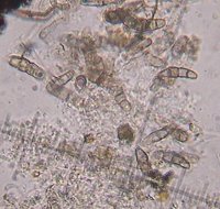Pyrenomycete spores MykoGolfer