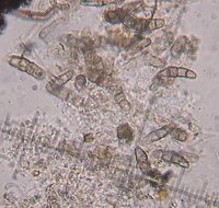 Pyrenomycete spores  MykoGolfer