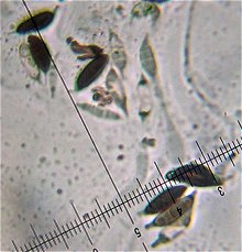 Rosellinia thelena spores  MykoGolfer