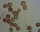 Scleroderma bovista spores  MykoGolfer