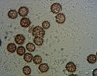 Scleroderma bovista spores MykoGolfer