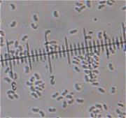 Sistotrema brinkmanii MykoGolfer