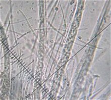 Stictis stellata spores  MykoGolfer