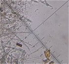 Subulicystidium longisporum MykoGolfer