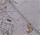 Subulicystidium longisporum  MykoGolfer