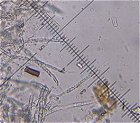 Subulicystidium longisporum MykoGolfer