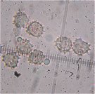 Tomentella spores MykoGolfer