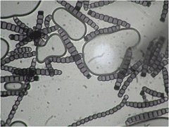 Torula herbarum MykoGolfer