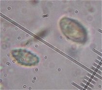 Unknown fungus spores MykoGolfer