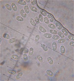 spores  MykoGolfer