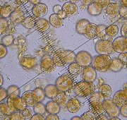 spores x400 from the unknown fungus  MykoGolfer