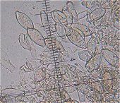 Botryobasidium aureum spores MykoGolfer
