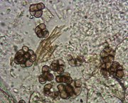 Cheiromycella microspora MykoGolfer