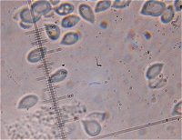 Cylindrobasidium laeve spores  MykoGolfer