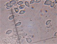 Cylindrobasidium laeve spores MykoGolfer
