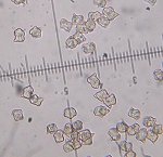 Entoloma conferendum spores MykoGolfer