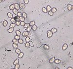 Entoloma sericeum spores  MykoGolfer