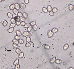 Entoloma sericeum spores MykoGolfer
