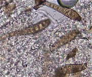 Helminthosporium velutinum MykoGolfer