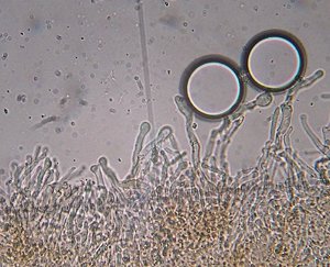 Simocybe haustellaris cystidia MykoGolfer