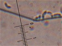 Skeletocutis amorpha spores  MykoGolfer