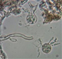 Stypella vermiformis basidia MykoGolfer