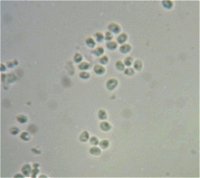 Stypella vermiformis spores MykoGolfer