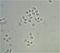 Stypella vermiformis spores  MykoGolfer