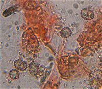 Tomentella pilosa spores MykoGolfer
